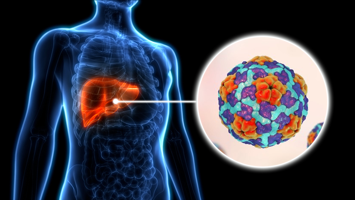 Close up drawing of Hepatitis A virus and where it infects the body