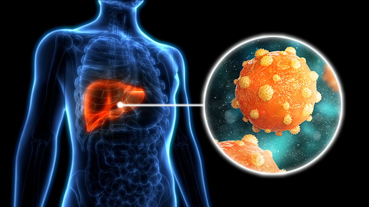 Close up drawing of Hepatitis B virus and where it infects the body