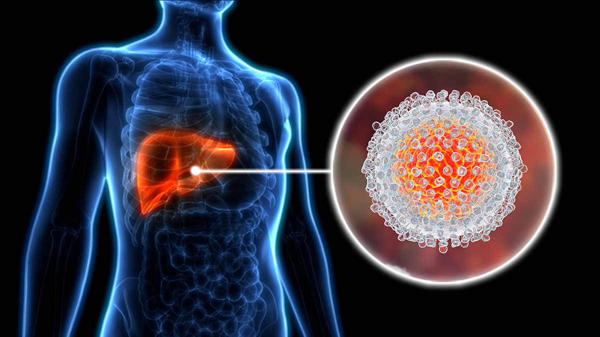 Close up drawing of Hepatitis C virus and where it infects the body