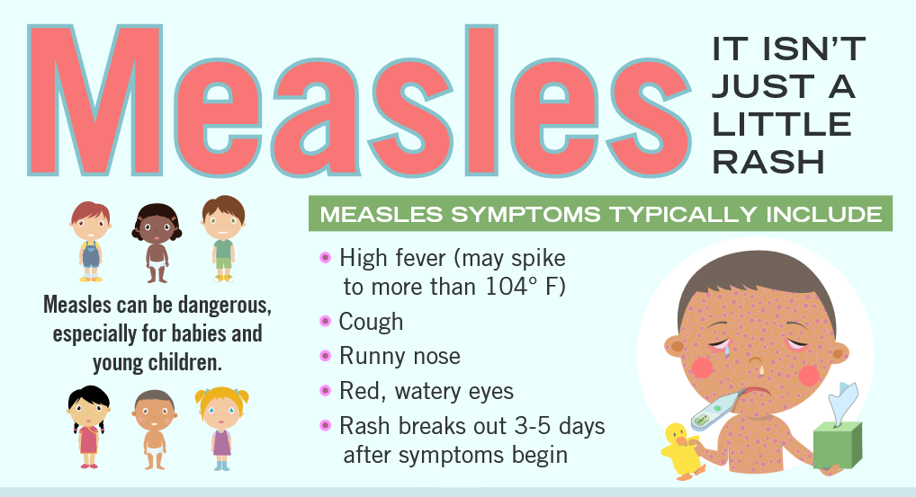 Measles CDC