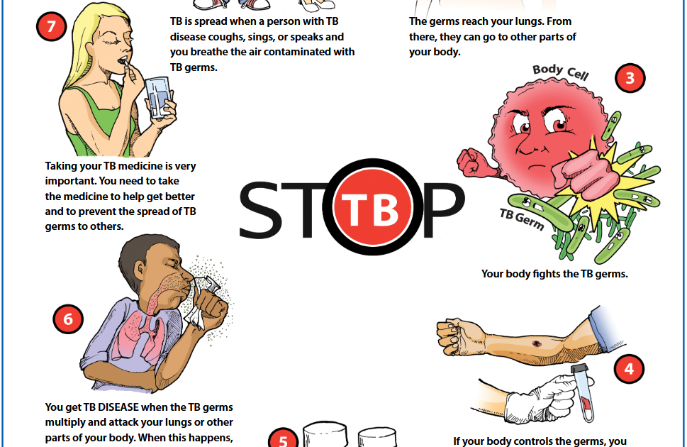 Stop TB