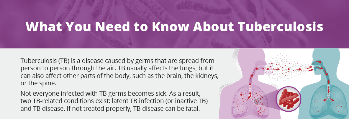 What you need to know about tuberculosis