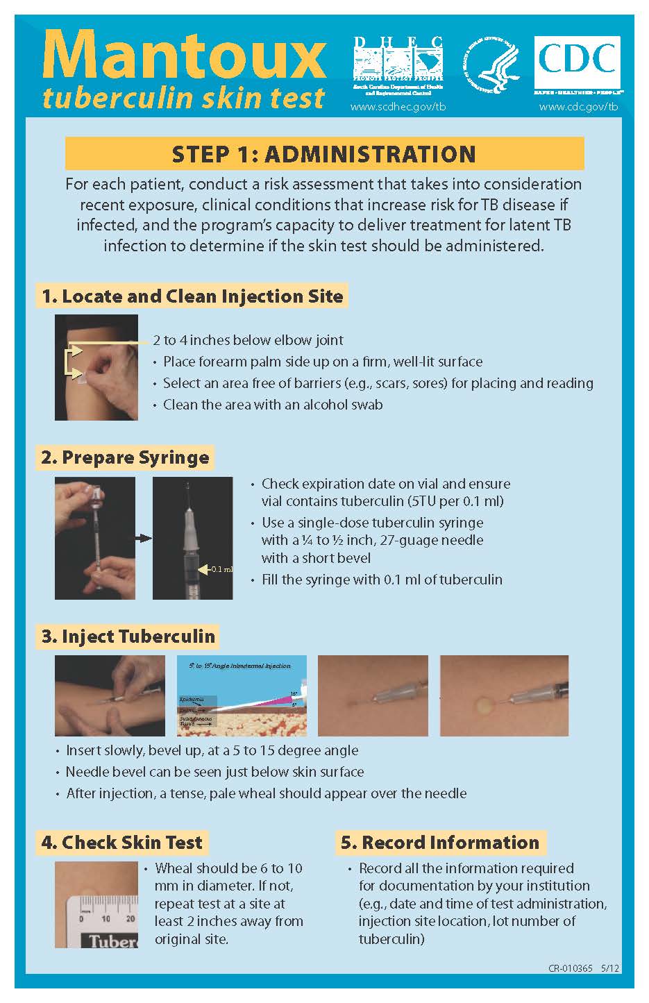Mantoux Tuberculin Skin Test poster image