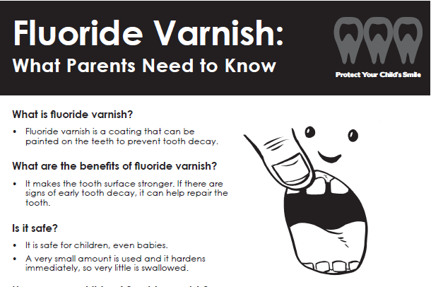 Fluoride Varnish: What Parents Need to Know (pdf)