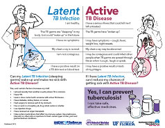 Facts about TB Image