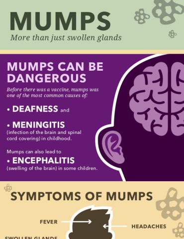 Mumps - More than just swollen glands